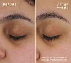 Advanced Regenerative Eye Serum