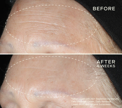 Collagen Reset Regimen