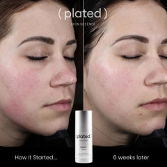 (PLATED)® Daily Serum