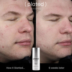 (PLATED)® Daily Serum