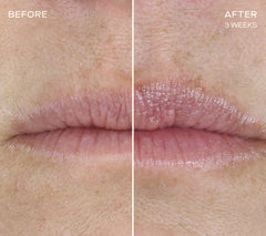 The Lip Plumping and Enhancing Regimen