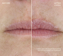 Replenishing Lip Filler